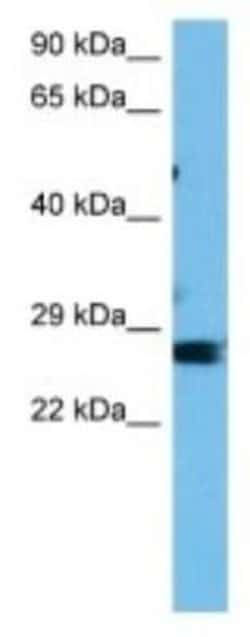 Glutathione S-Transferase pi 1/GSTP1 Rabbit anti-Mouse, Polyclonal, Novus